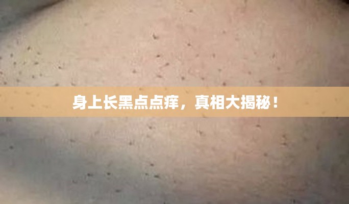 身上长黑点点痒,真相大揭秘!